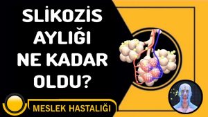 Silikozis Aylığı Nedir? Ne Kadar? Nasıl Alınır?