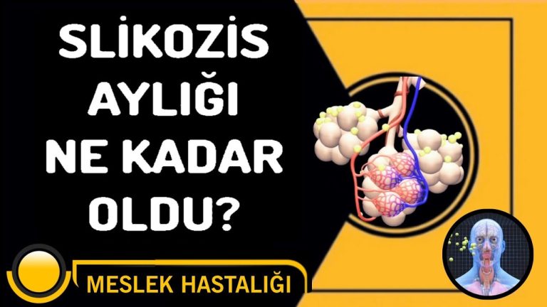 Silikozis Aylığı Nedir? Ne Kadar? Nasıl Alınır?